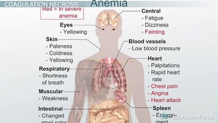 Irreversible Cellular Injury and Death: Types and Causes