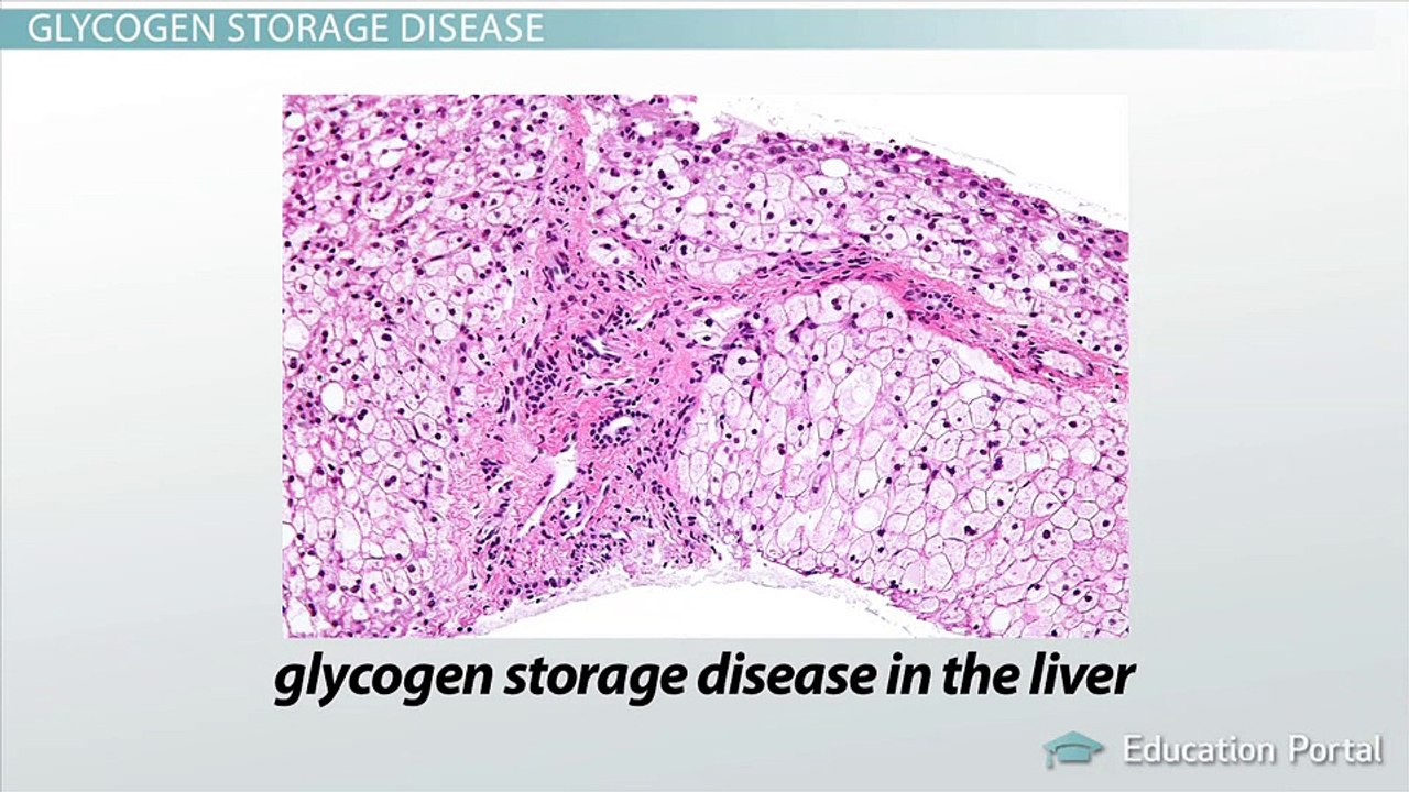 The Consequences of Intracellular Accumulations