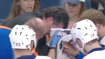 Islanders Coach Jack Capuano Takes A Puck to the Face, Returns to Game