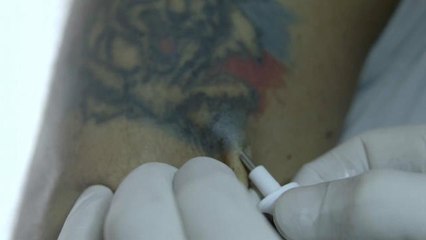 En Argentine, une puce dans le bras pour entrer au stade - Le 28/04/2016 à 20h30