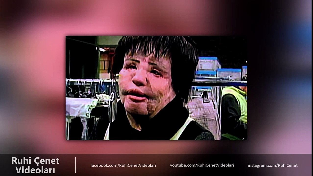 Dünyanın En KORKUNÇ 10 Estetik AMELİYATI