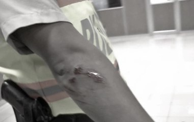 Policía fue agredido por un presunto expendedor en la vía a la costa