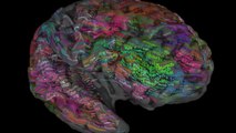 Amazing Brain Map Shows Where Words Are Stored in Your Noggin