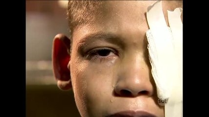 Exclusivo: Menino fica cego durante operação policial em favela