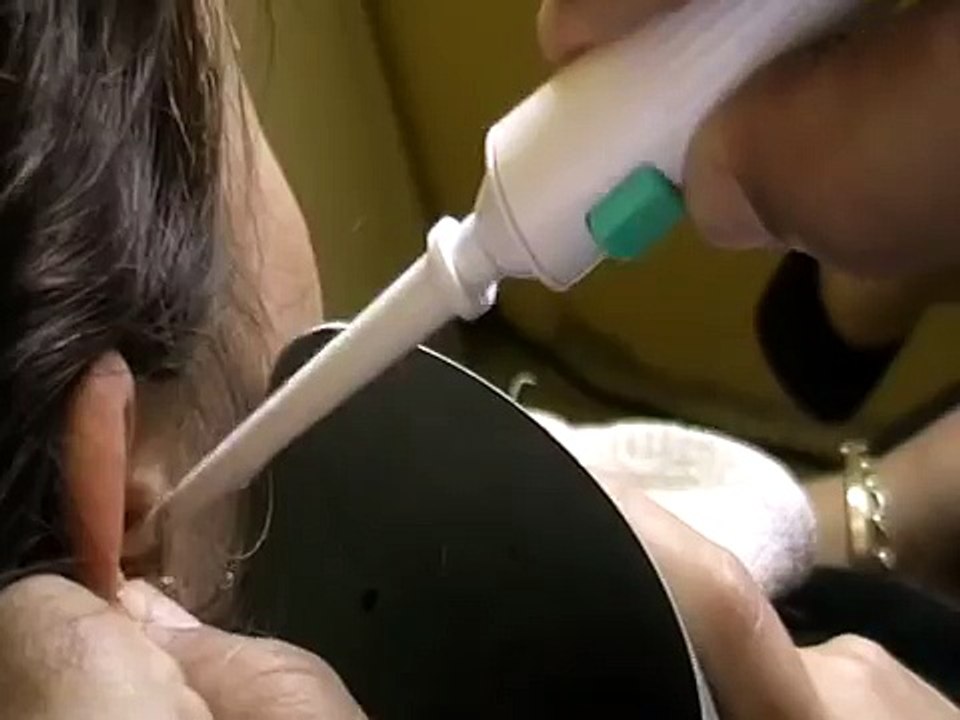 Technique of removing wax from a patients ear using a jet propulsing device