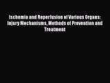 [Read book] Ischemia and Reperfusion of Various Organs: Injury Mechanisms Methods of Prevention