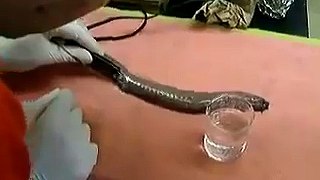 Oho - Snakes Examination In Lab - Dailymotion Videos - Tubeinto.com