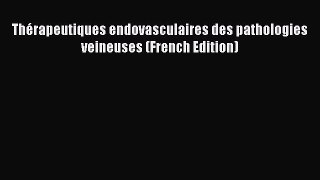 Download Thérapeutiques endovasculaires des pathologies veineuses (French Edition) Ebook Online