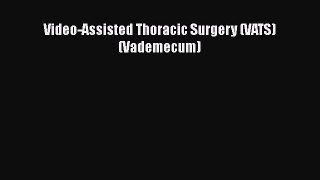 Download Video-Assisted Thoracic Surgery (VATS) (Vademecum) Ebook Free