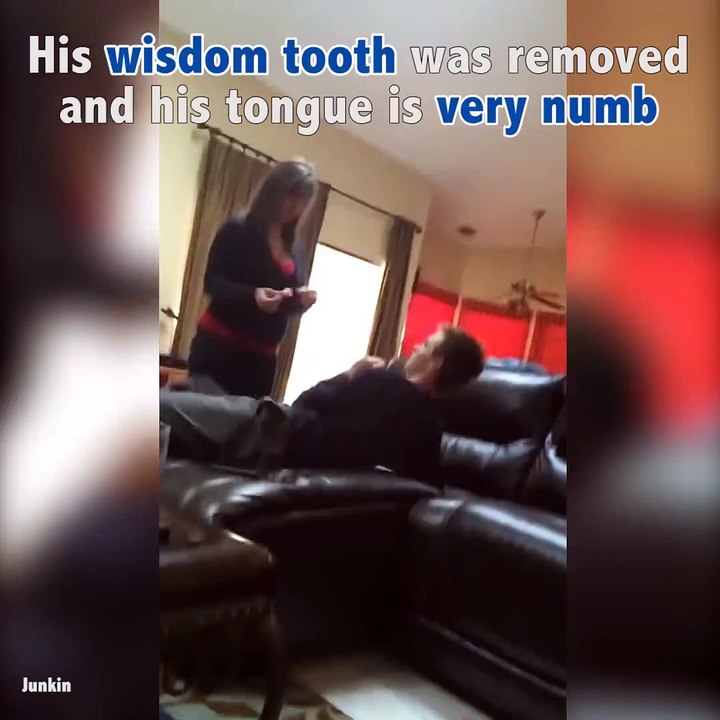 Extreme wisdom tooth reaction
