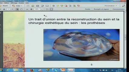 Atelier Cancer 2-La reconstruction post-mastectomie, par Cinzia Greco