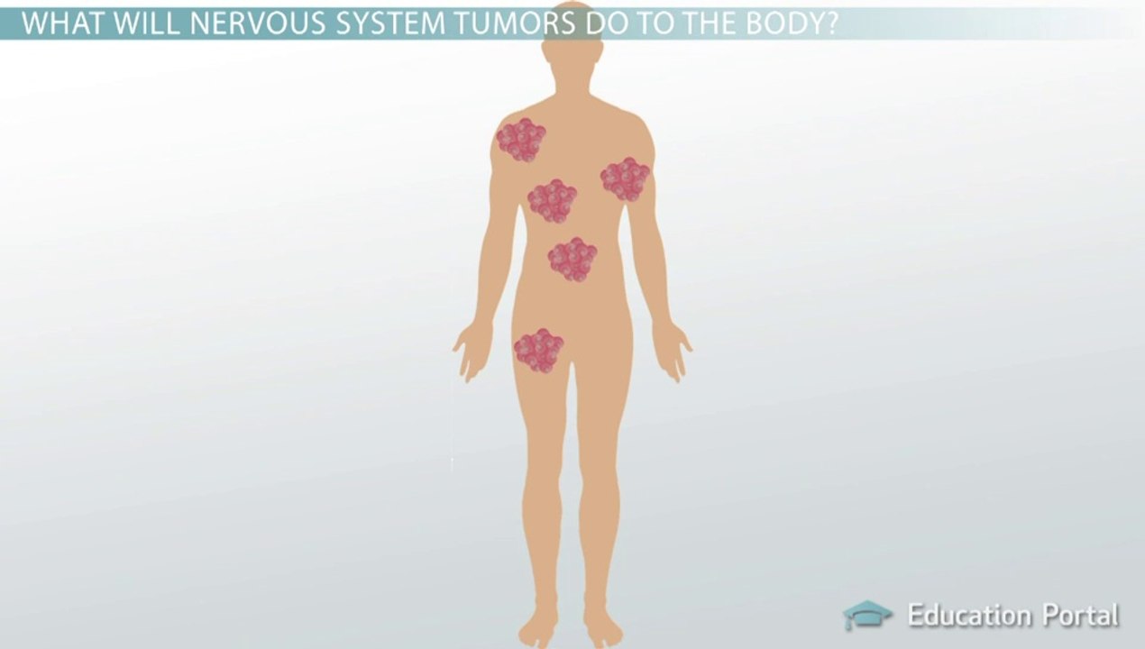 Nervous System Tumors: Gliomas, Meningiomas, and More