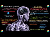 Guillain-Barre Syndrome(CBS): Causes, Symptoms & Diagnosis