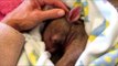 Wombat Snuggles Into New Human Mum While Recovering From Tick Bites