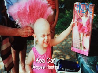 Bayan Protez Saç Uygulaması