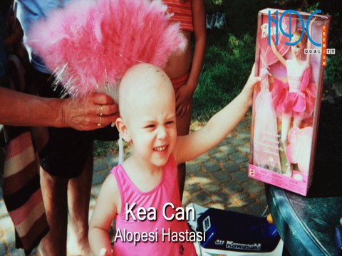 Bayan Protez Saç Uygulaması