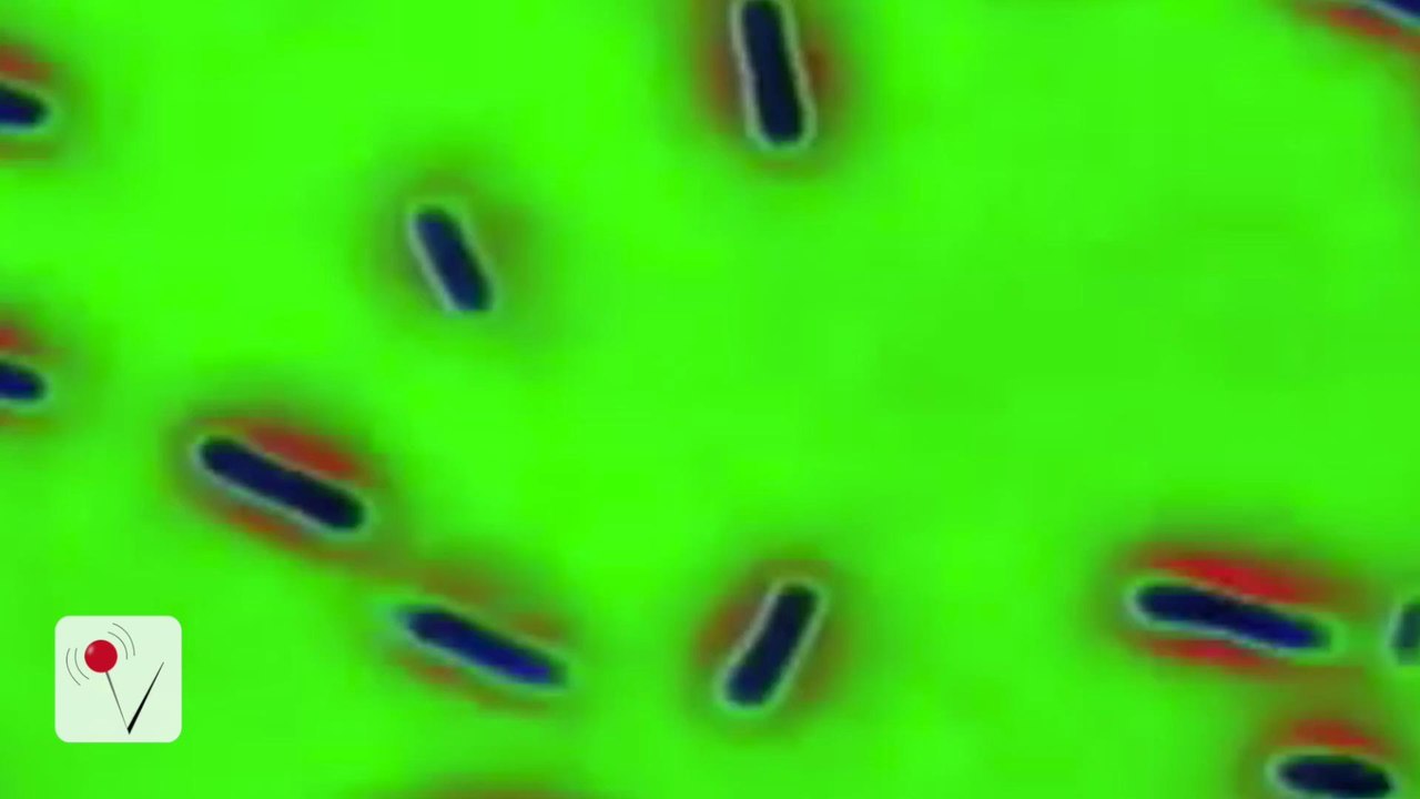 Listeria Outbreak Recalls Hundreds of Products