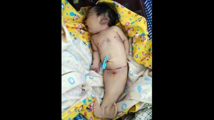 Mermaid Tails Are Mermaid Real ? Real Mermaid Kid in Myanmar 2015