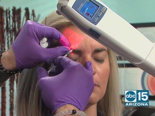 Contour Medical can take years off your face with Dysport injections