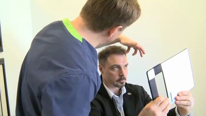 Types of Hair Transplants - New York, New Jersey