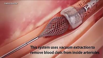 Hearts can be safer in future with new technology