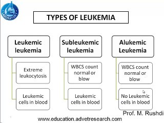 Types of Leukemia Explained 🩸