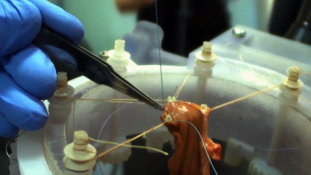 Los robots cirujanos empiezan a operar de forma autónoma