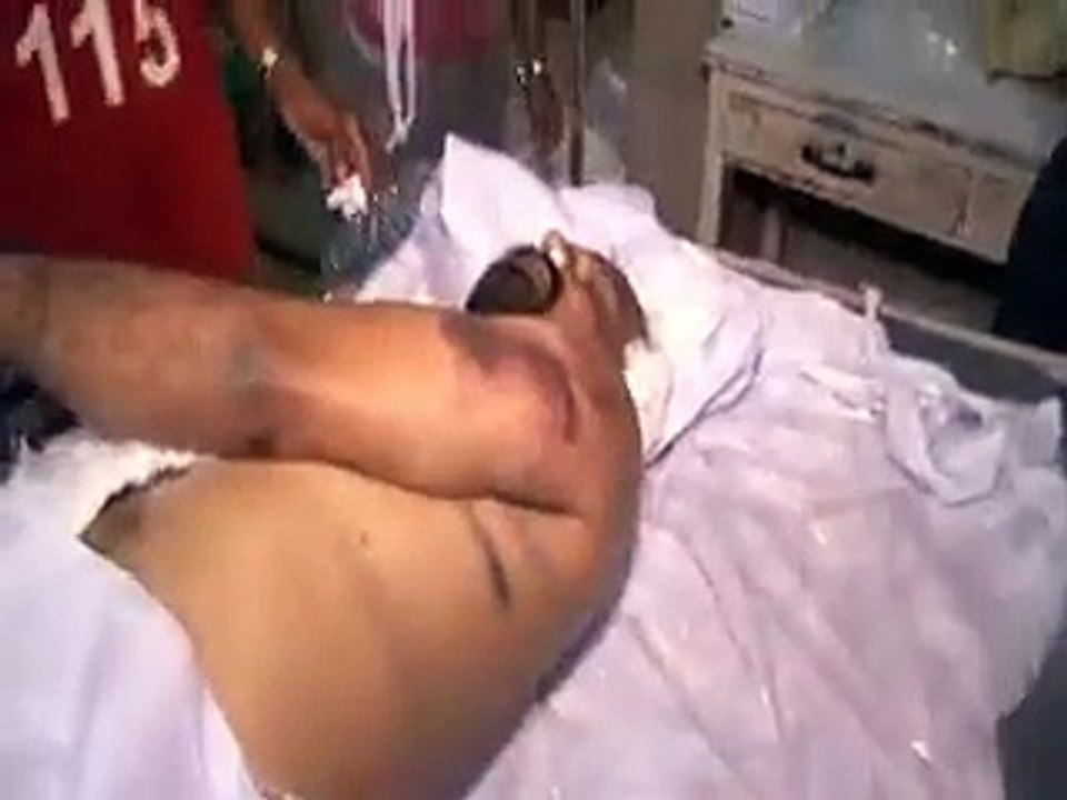 What Happend  Gruesome footage of 3rd degree torture On Remand