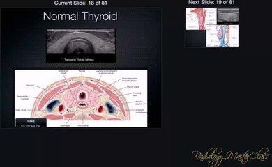 8- Head and Neck Ultrasound Part-A