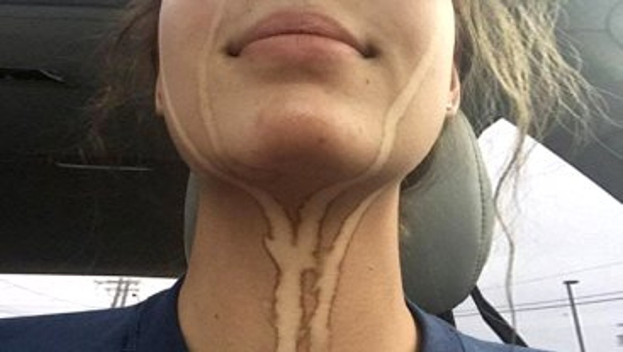 Bronzlaştıktan Sonra Ağlayan Kızın Fotoğrafı Rekor Kırdı