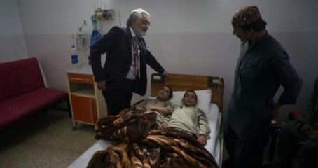 Doktorların Şaşıp Kaldığı Vaka! İki Kardeş, Güneş Batınca Felç Oluyor