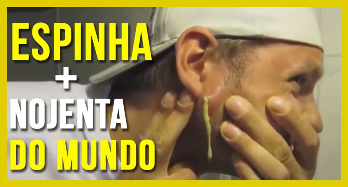 Espinha olha o tamanho disso