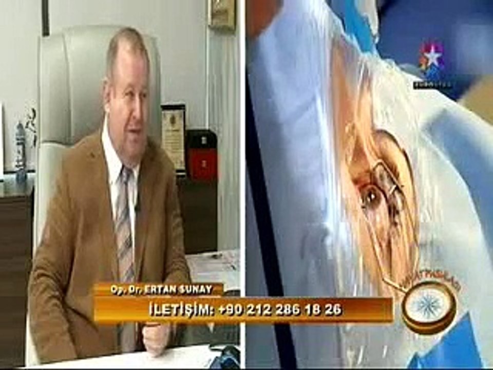 Op.Dr.Ertan Sunay Euro Star’da Hayat Pusulası programı No Touch Laser