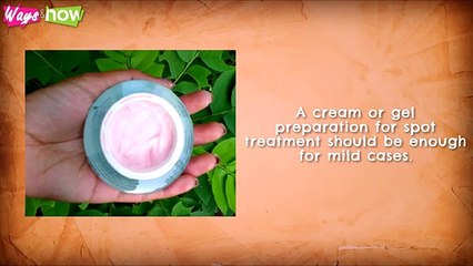 How to Get Rid of Pimples - 10 Simple Ways