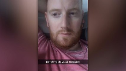 Man's bionic heart valve makes bizarre 'tick-tock' sound