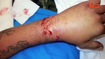 Alligator Attack Caught on Camera Huge Reptile Snaps Man's Hand