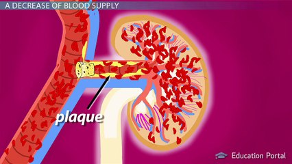 Acute Renal Failure: Prerenal Failure & Its Effects On The Body