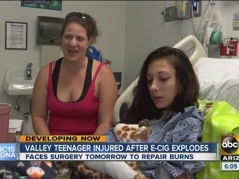 Valley teen injured after e-cig explodes