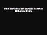 [PDF] Acute and Chronic Liver Diseases: Molecular Biology and Clinics Read Full Ebook