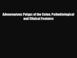 [PDF] Adenomatous Polyps of the Colon: Pathobiological and Clinical Features Download Full