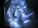 20 week sonogram pics 012.avi