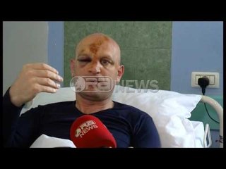 Gazetari Ilnica rrëfen momentet e tmerrit: Mendova se po të më fusnin në makinë do të më eliminonin