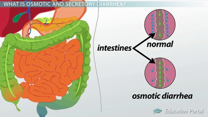 General Motility Disorders: Diarrhea and Constipation