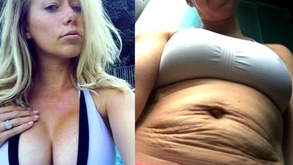 Kendra Wilkinson shared this controversial photo of her stretch marks on Instagram.
