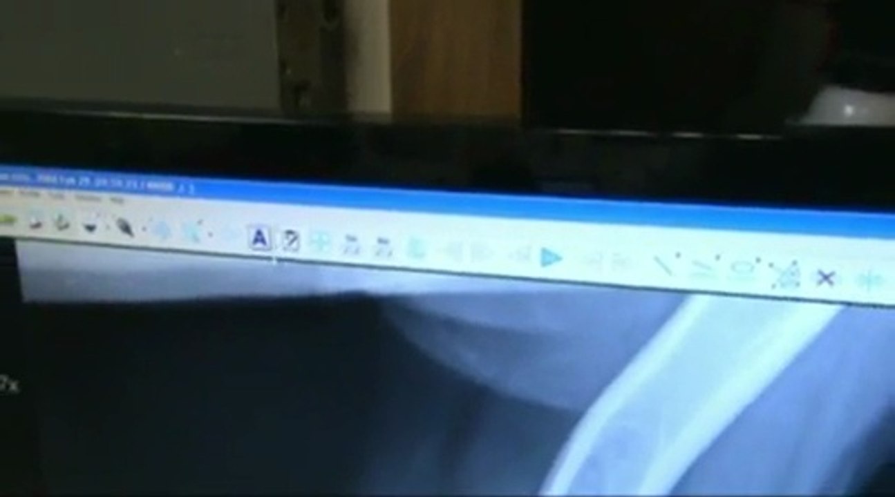 Digital X-Ray Presentation