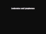 [PDF] Leukemias and Lymphomas Download Full Ebook