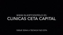 CLINICAS CETA CAPITAL www.injertodepelo.es