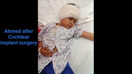 Ahmed after Cochlear implant surgery Very Hard Time for Parents 28 NOV 2015