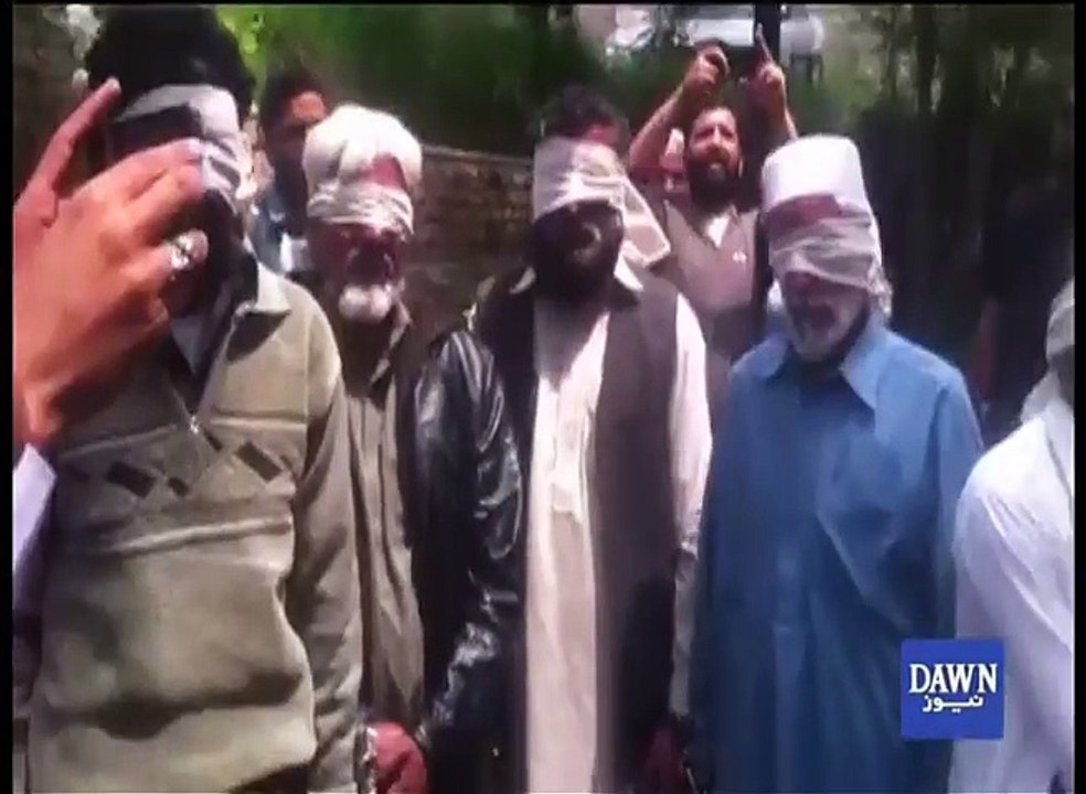 Girl set on fire as 'punishment' by Abbottabad jirga