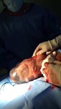 C'est un accouchement bien normal, mais quand les docteurs voient ça, ils se précipitent vers leur téléphone pour filmer